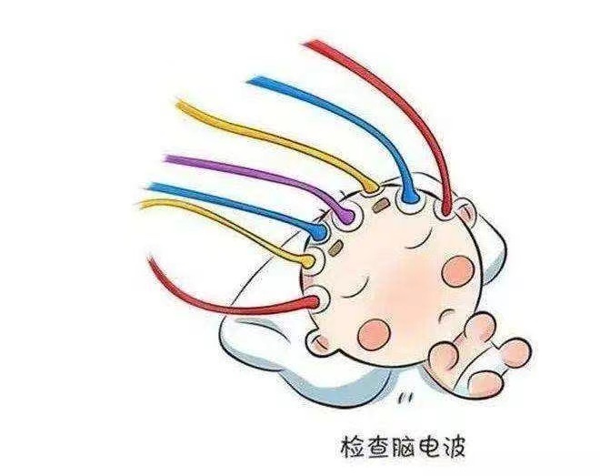 癫痫患者脑电图检查的重要性如何？