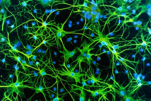 科学家摸清脑电击作用机制